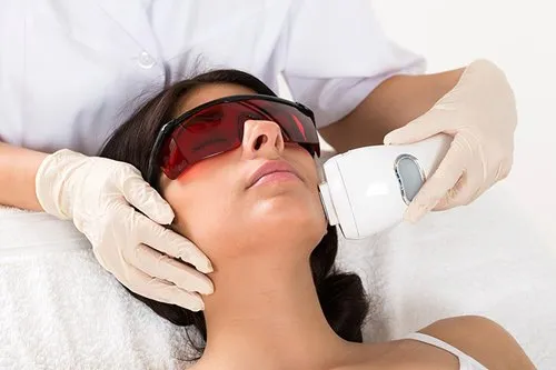 LASER HAIR REMOVAL